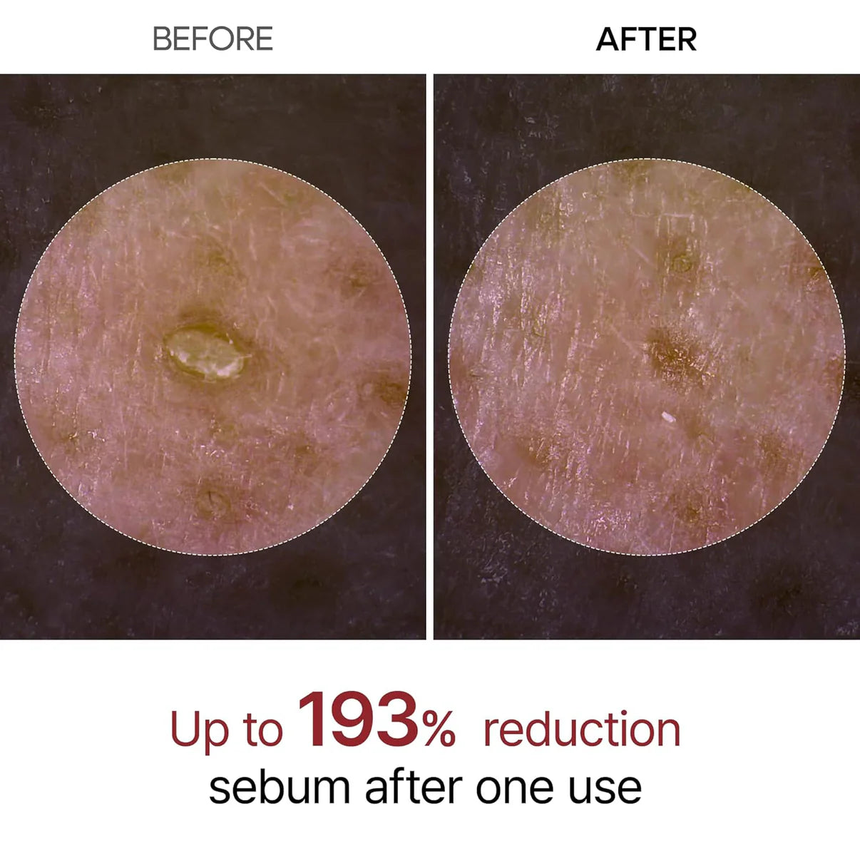 Eloria Rice Peel Serum Ampoule™