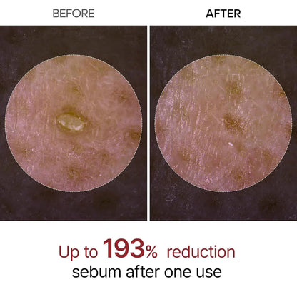 Eloria Rice Peel Serum Ampoule™
