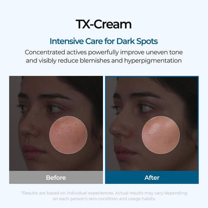 TX - Cream